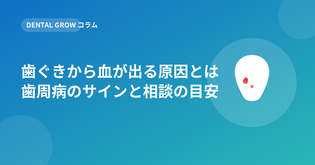 歯ぐきから血が出る原因とは歯周病のサインと相談の目安